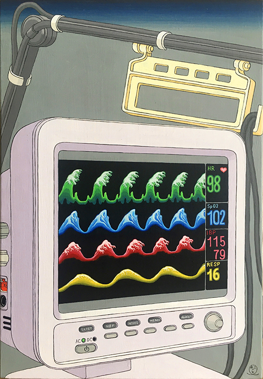 家電図 心電図